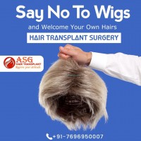 Hair Transplant in India asghairtransplant